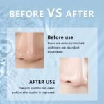 Pore Cleaner - Image 3